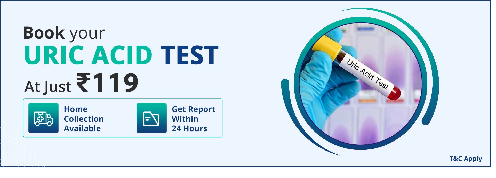 Uric Acid Test